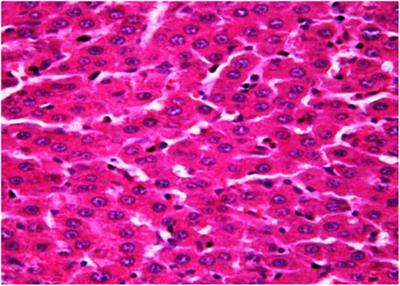 Antiradical and Cytoprotective Properties of Allium nutans L. Honey Against CCL4-Induced Liver Damage in Rats